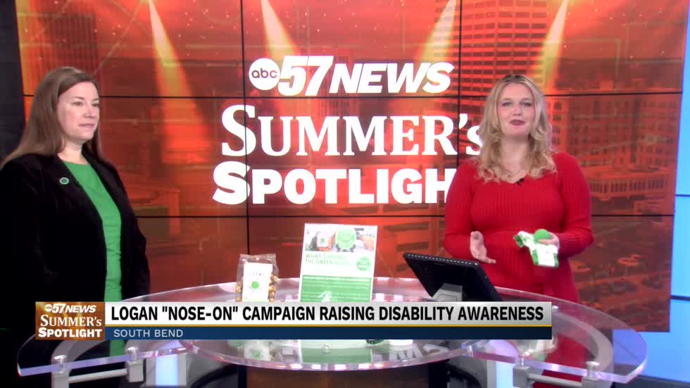 ABC57’s Summer’s Spotlight: Logan “Nose-On” campaign raising disability awareness [Video]